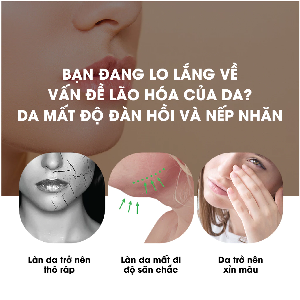 vn-11134207-7ras8-mbndcnkq4twgcf